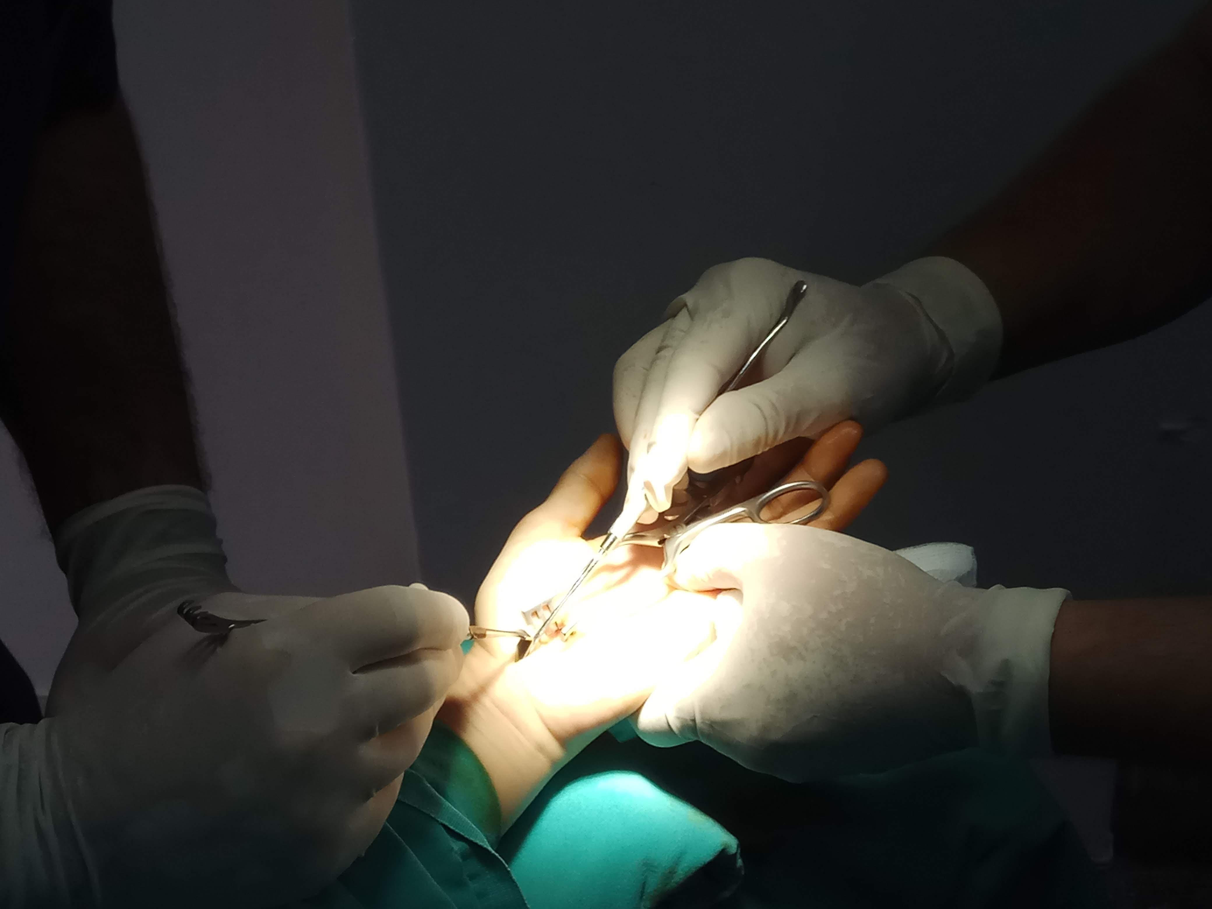 Χειρουργική επέμβαση άνω άκρου
